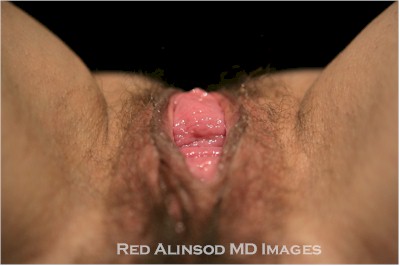 Top View